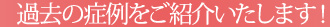 過去の症例をご紹介いたします！